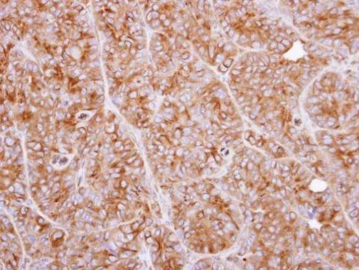 Anti-TPP1 Antibody