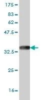 Anti-ZIC4 Antibody
