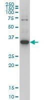 Anti-ZIC4 Antibody