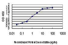 Anti-ZIC4 Antibody