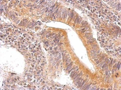 Anti-ENO3 Antibody