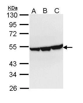 Anti-ENO3 Antibody