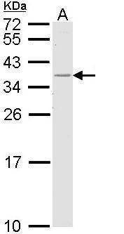 Anti-HLA-DR Antibody