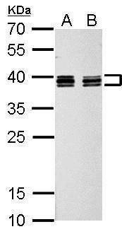Anti-hnRNP C1/C2 Antibody