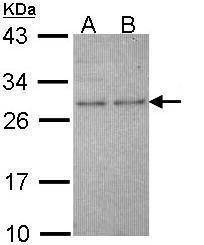 Anti-HPRT Antibody