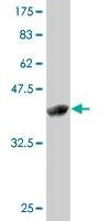 Anti-ZMAT4 Antibody