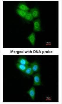 Anti-PSMB8 Antibody