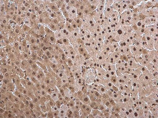 Anti-PSMB8 Antibody