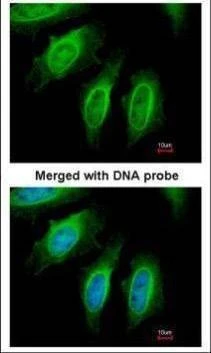 Anti-EEN Antibody