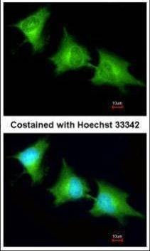 Anti-SPR Antibody
