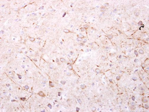 Anti-SPR Antibody
