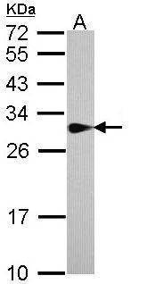 Anti-SPR Antibody