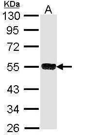 Anti-SSA1 Antibody