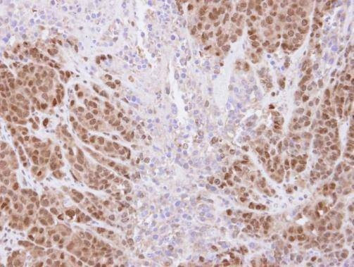 Anti-SSA1 Antibody