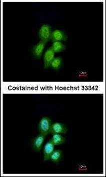 Anti-MVP/LRP Antibody