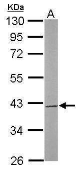 Anti-SAE1 Antibody