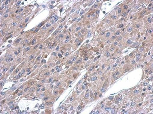 Anti-ASL Antibody