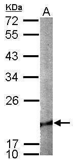 Anti-Cofilin 2 Antibody