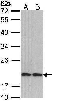 Anti-Cofilin 2 Antibody