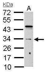 Anti-HUS1 Antibody