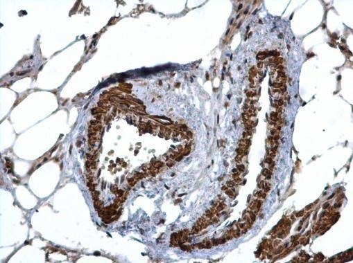 Anti-HUS1 Antibody