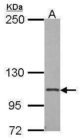 Anti-Integrin alpha 2b (internal) Antibody