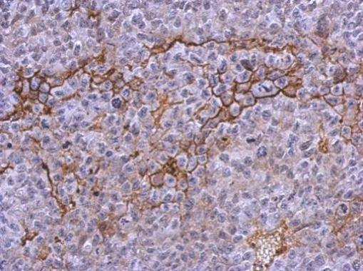 Anti-Integrin alpha 2b (internal) Antibody