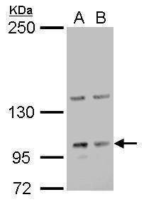 Anti-Laminin gamma 2 (internal) Antibody