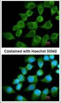 Anti-NDUFS1 Antibody
