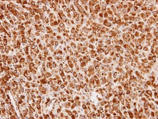 Anti-Cullin 7 (C-term) Antibody