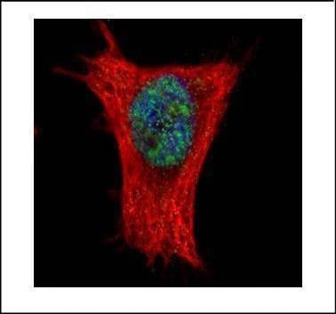 Anti-ALY Antibody