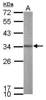 Anti-ALY Antibody