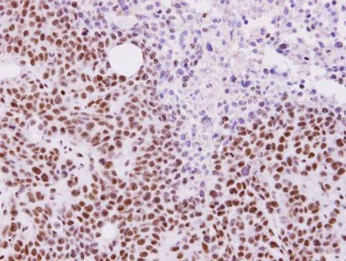 Anti-ALY Antibody