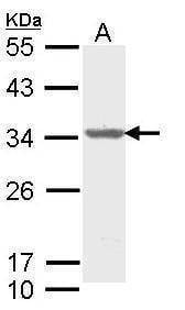 Anti-ALY Antibody