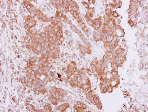Anti-PIM2 Antibody