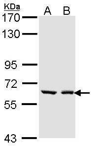 Anti-UGT1A6 Antibody