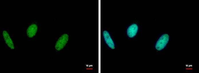 Anti-RAD18 Antibody