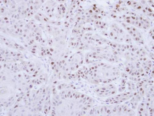Anti-RAD18 Antibody