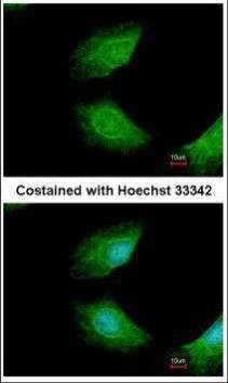 Anti-CIAPIN1 Antibody