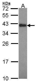 Anti-CIAPIN1 Antibody