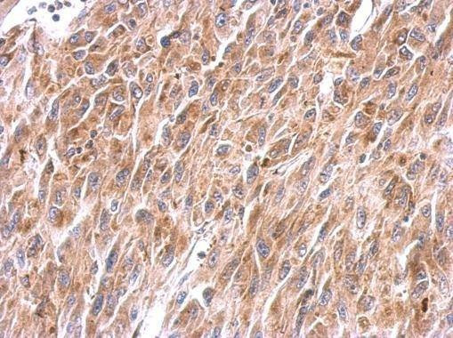 Anti-NDUFS8 Antibody
