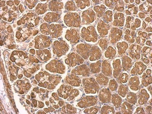 Anti-NDUFS8 Antibody