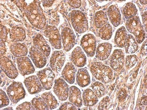 Anti-NDUFS8 Antibody