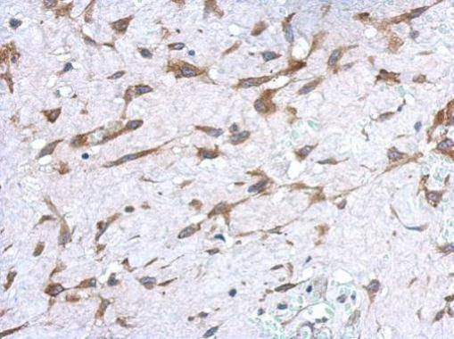 Anti-UGT1A9 Antibody