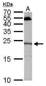 Anti-RGS4 Antibody