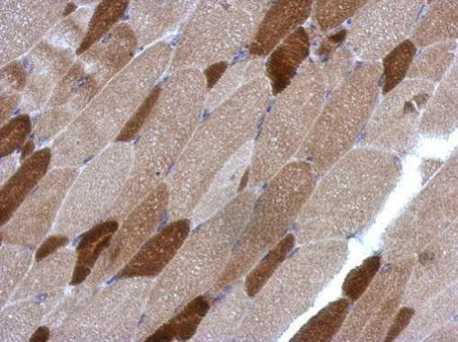 Anti-RGS4 Antibody