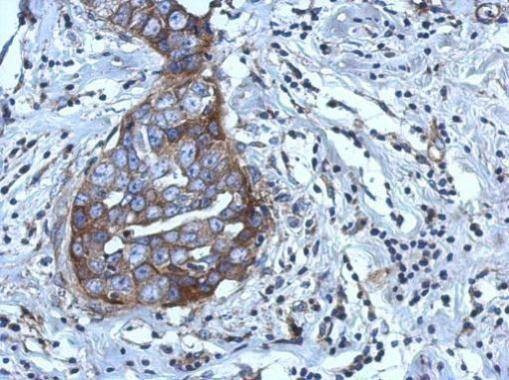 Anti-RGS4 Antibody