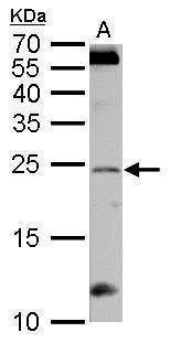 Anti-RGS4 Antibody