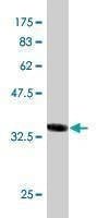 Anti-AKAP4 Antibody