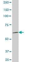 Anti-AKAP4 Antibody